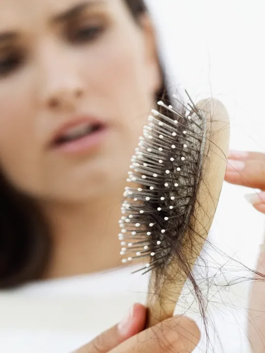 Woman holds brush filled with lost hair.