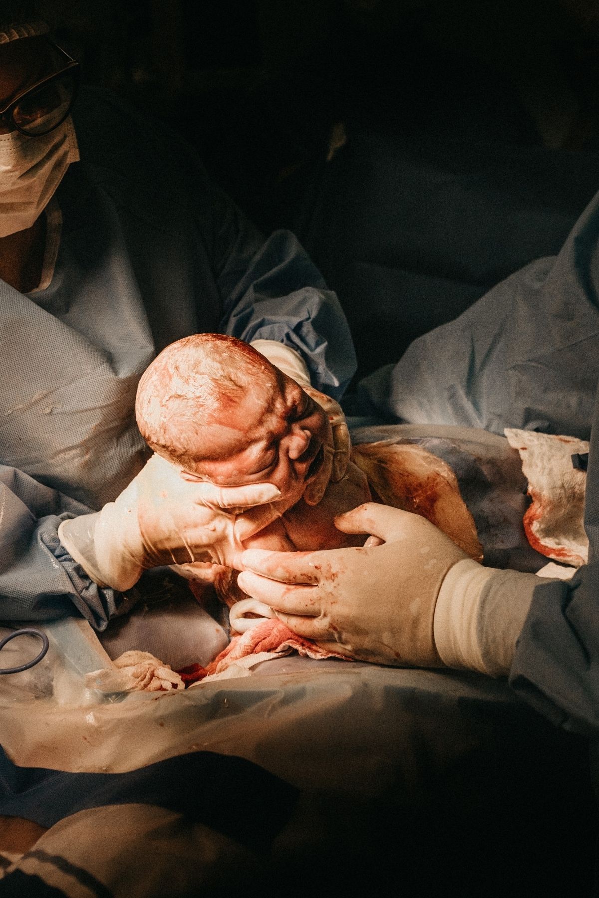Nurses pull a newborn baby from its mothers womb during a c-section delivery.