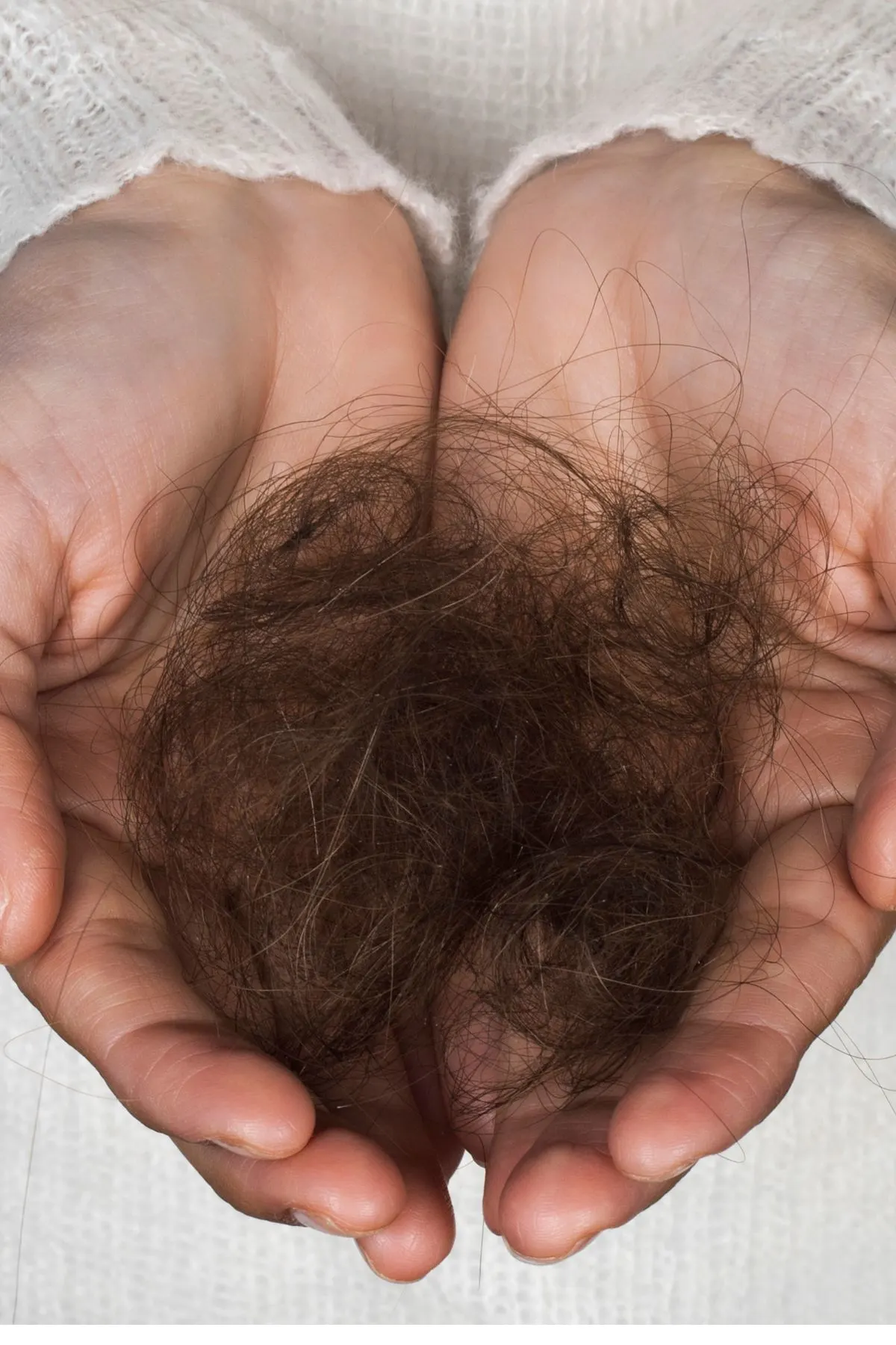 A woman holds out her hands with a ball of hair that has shed from her scalp.