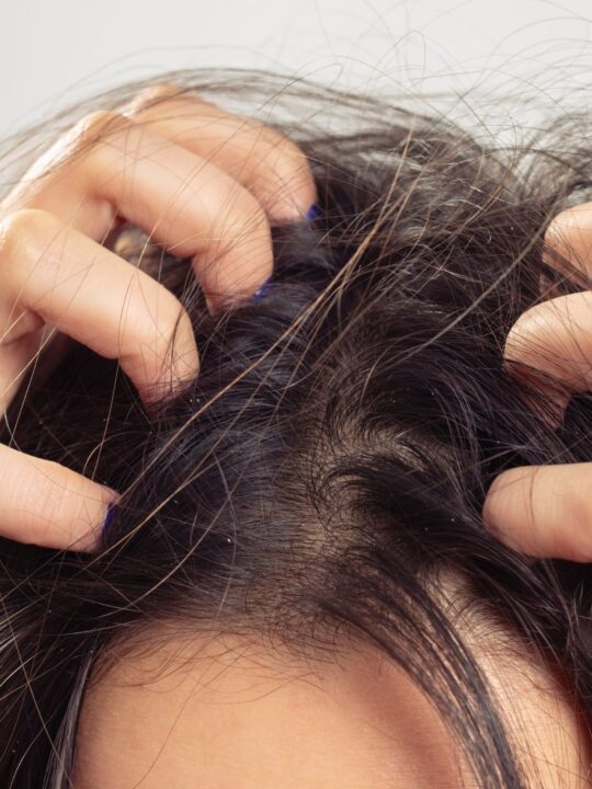 Close up view of a woman with dark hair scratching her itchy scalp.